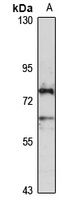 Anti-HHIP Antibody