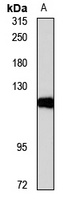 HKDC1 antibody