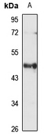 Anti-HLA-F Antibody