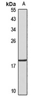 Anti-HMGA2 Antibody
