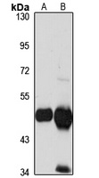 Anti-HMGCS2 Antibody