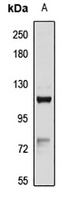 Anti-HMHA1 Antibody