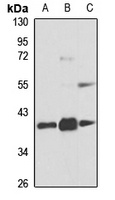 hnRNP D antibody