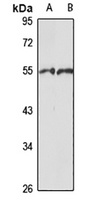 Anti-hnRNP H1 Antibody
