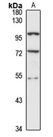 hnRNP H2 antibody