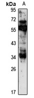 HOXC11 antibody