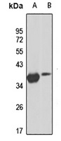 Anti-HOXD10 Antibody