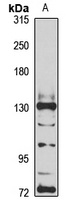 Anti-HPS5 Antibody