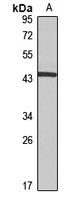 Anti-HSD11B2 Antibody