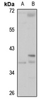 HSD17B1 antibody