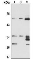 Anti-HSD17B6 Antibody