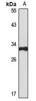 TIP30 antibody