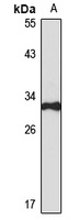 Anti-TIP30 Antibody