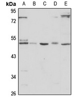 Anti-HTRA3 Antibody