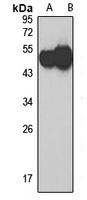 Anti-HYAL1 Antibody