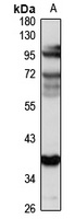 ICA69 antibody