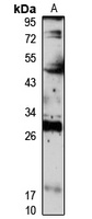 Anti-IDI2 Antibody