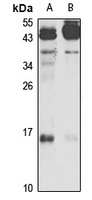 Anti-IEX1 Antibody