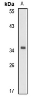Anti-IFI35 Antibody