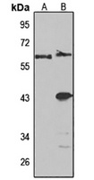 Anti-IFIT3 Antibody