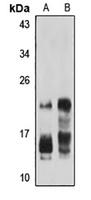 Anti-IFN alpha 8 Antibody