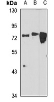 Anti-IFT74 Antibody