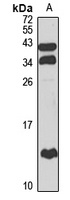 Anti-IGFL3 Antibody