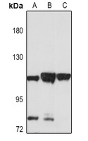 IGHMBP2 antibody