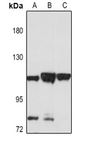Anti-IGHMBP2 Antibody