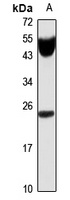 Anti-IL-11 Antibody