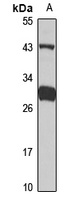 Anti-IL-1RL1 Antibody