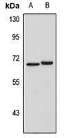 Anti-IL-22R Antibody