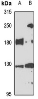 Anti-INF2 Antibody