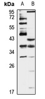 ING2 antibody