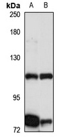 Anti-INTS7 Antibody