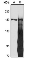 IQGAP2 antibody