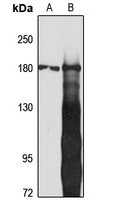 Anti-IQGAP2 Antibody
