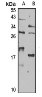Anti-ISCU Antibody