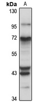 Anti-ITCH Antibody