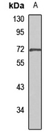 Emt antibody