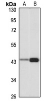 Anti-IVD Antibody