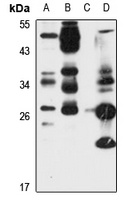 Anti-Josephin-1 Antibody