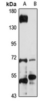 Anti-JRKL Antibody