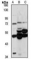 KBTBD3 antibody