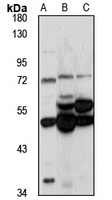 Anti-KBTBD3 Antibody