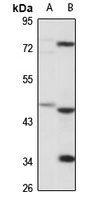 Kir7.1 antibody