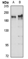 Anti-KIAA1429 Antibody