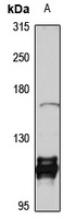 Anti-KIF16B Antibody