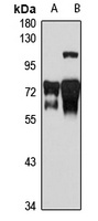 KIFC1 antibody