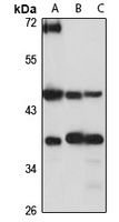 KIN17 antibody